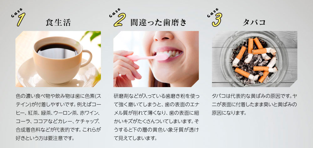 Case1食生活　色の濃い食べ物や飲み物は歯に色素(ステイン)が付着しやすいです。例えばコーヒー、紅茶、緑茶、ウーロン茶、赤ワイン、コーラ、ココアなどカレー、ケチャップ、合成着色料などが代表的です。これらが好きという方は要注意です。　Case2間違った歯磨き　研磨剤などが入っている歯磨き粉を使って強く磨いてしまうと、歯の表面のエナメル質が削れて薄くなり、歯の表面に細かいキズがたくさんついてしまいます。そうすると下の層の黄色い象牙質が透けて見えてしまいます。　Case3タバコ　タバコは代表的な黄ばみの原因です。ヤニが表面に付着したまま臭いと黄ばみの原因になります。