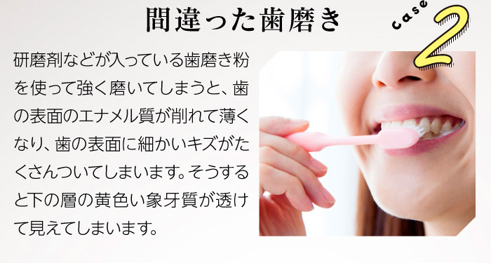 Case2間違った歯磨き　研磨剤などが入っている歯磨き粉を使って強く磨いてしまうと、歯の表面のエナメル質が削れて薄くなり、歯の表面に細かいキズがたくさんついてしまいます。そうすると下の層の黄色い象牙質が透けて見えてしまいます。