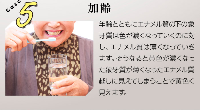 case5加齢　年齢とともにエナメル質の下の象牙質は色が濃くなっていくのに対し、エナメル質は薄くなっていきます。そうなると黄色が濃くなった象牙質が薄くなったエナメル質越しに見えてしまうことで黄色く見えます。